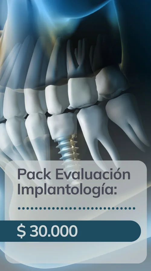 Pack evaluacion implantologia 1 jpg