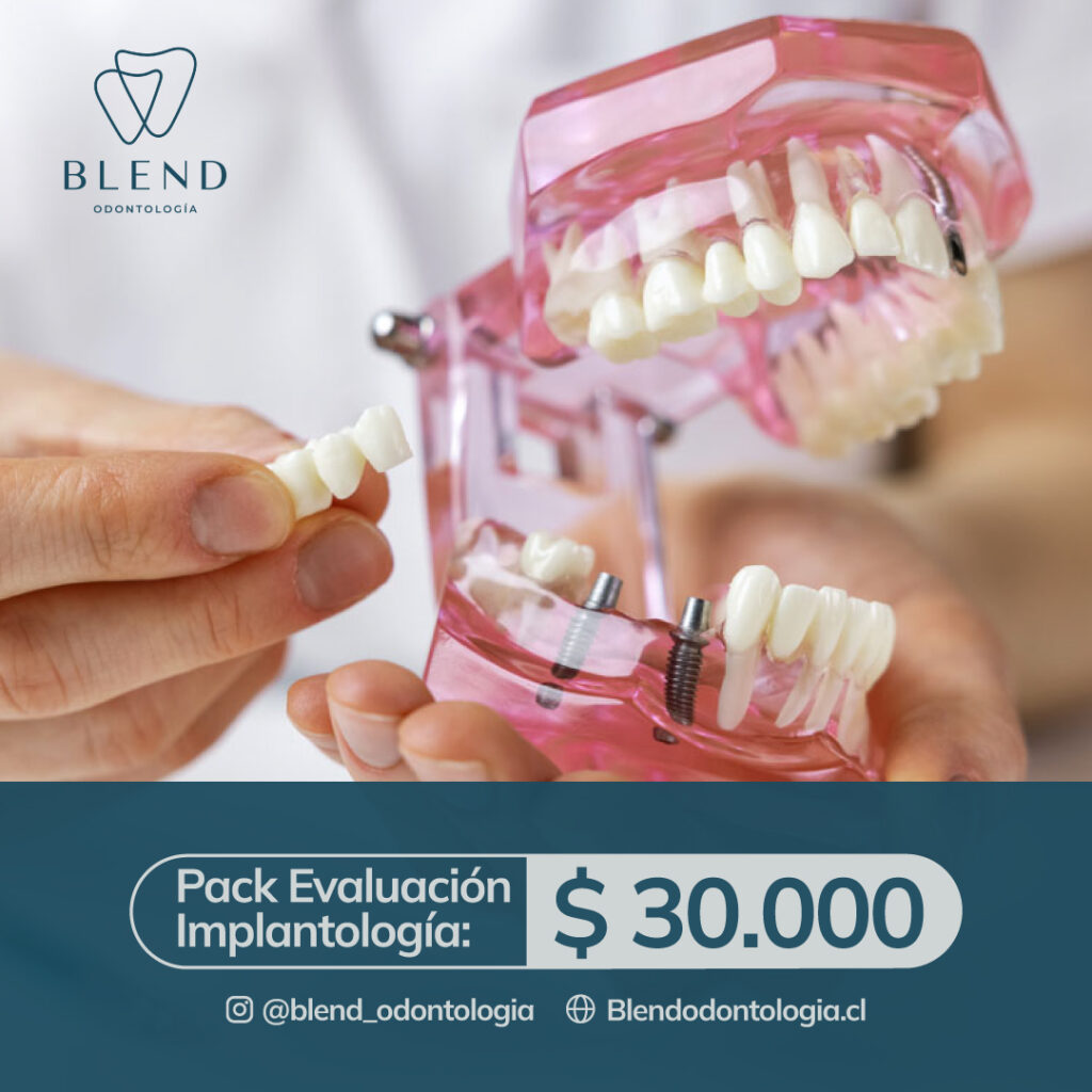 cuadrada evaluacion implantologia