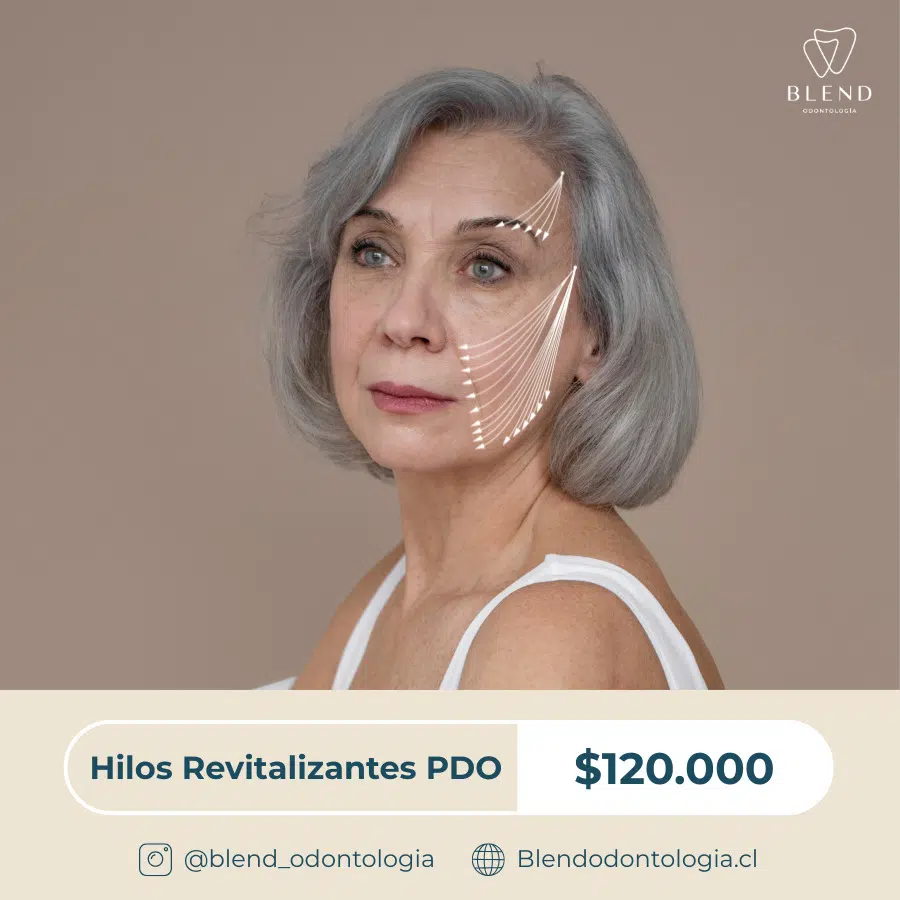 Banner Cuadrado Hilos PDO