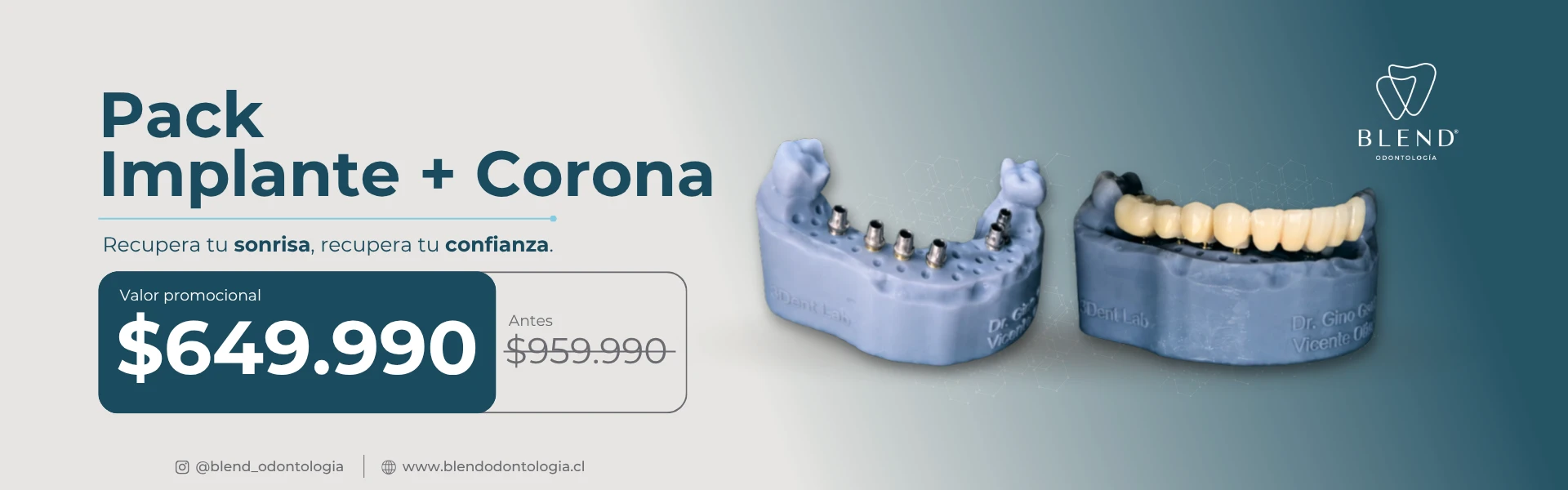 Pack ImplanteCorona 1920x600 1